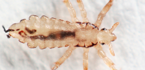 Kopfläuse: Detaillierte Fotos und Besonderheiten der Parasitenbiologie