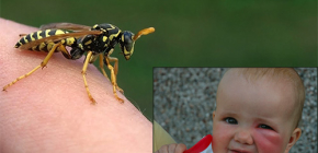 Was sollte man tun, wenn ein Kind plötzlich von einer Wespe gestochen wurde?