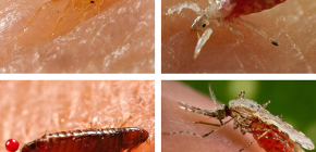Welche blutsaugenden Insekten im Bett oder Sofa vorkommen können