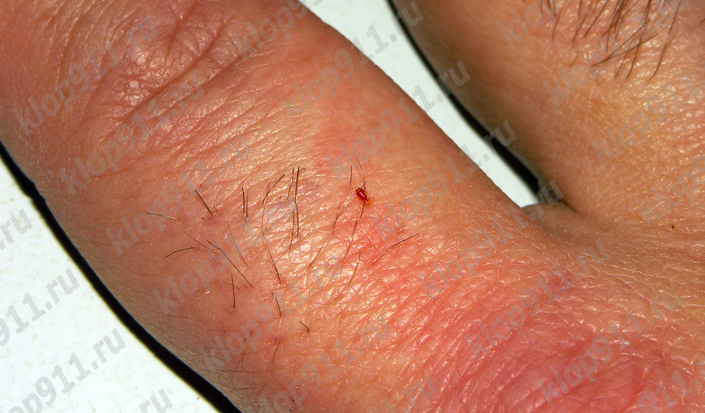 Larve trinkt Blut