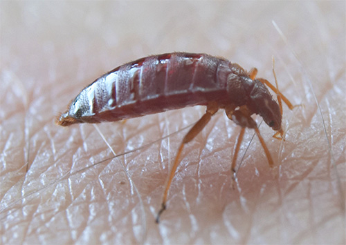 Die Wanze hat die Haut mit dem Rüssel durchstochen Die Wanze hat die Haut mit dem Rüssel durchstochen