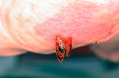 Beim Stich injizieren Bettwanzen Speichel, der eine Reihe biologisch aktiver Substanzen enthält. Beim Stich injizieren Bettwanzen Speichel, der eine Reihe biologisch aktiver Substanzen enthält.