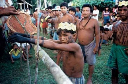 Nach Ameisenbissen können die Hände eines Menschen tatsächlich schwarz werden Nach Ameisenbissen können die Hände eines Menschen tatsächlich schwarz werden