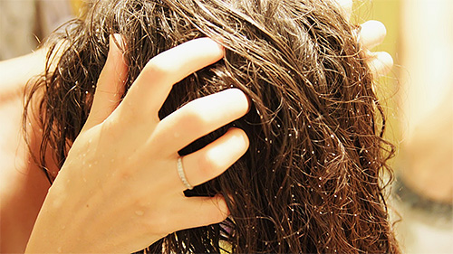 Nach dem Auftragen von Benzylbenzoat auf den Kopf sollten Sie das Mittel leicht in die Haare einmassieren. Nach dem Auftragen von Benzylbenzoat auf den Kopf sollten Sie das Mittel leicht in die Haare einmassieren.