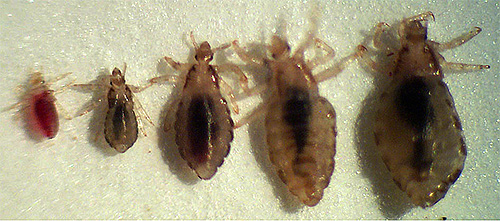 Auf dem Foto: eine erwachsene Kopflaus und Nymphen unterschiedlichen Alters