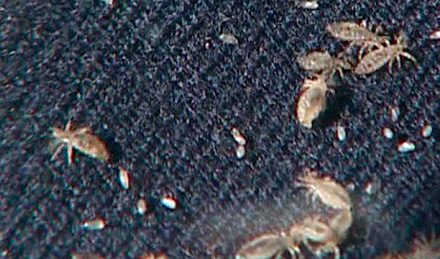 Wäschelässe in der Kleidung Wäschelässe in der Kleidung