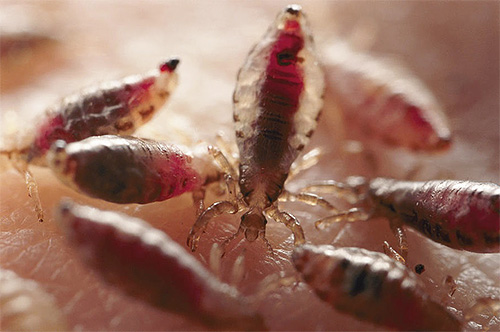 Kleiderläuse auf dem menschlichen Körper