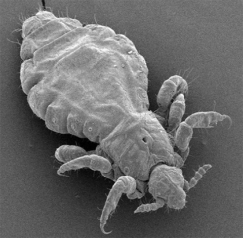 Kopflaus unter dem Mikroskop