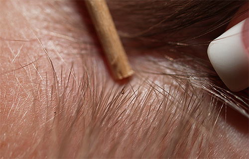 Um Läuse zu entdecken, müssen Sie vor allem die Haare Ihres Kindes gründlich untersuchen. Um Läuse zu entdecken, müssen Sie vor allem die Haare Ihres Kindes gründlich untersuchen.