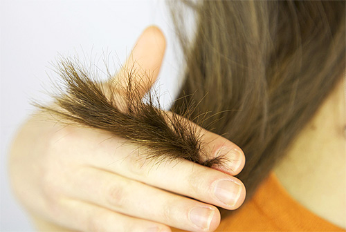 Bei falscher Anwendung von Essig können Haare und Kopfhaut geschädigt werden. Bei falscher Anwendung von Essig können Haare und Kopfhaut geschädigt werden.