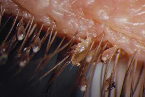 Ein weiteres Foto von Filzläusen und Nissen auf den Wimpern Ein weiteres Foto von Filzläusen und Nissen auf den Wimpern