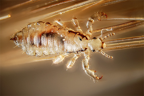 Kopflaus in den Haaren Kopflaus in den Haaren