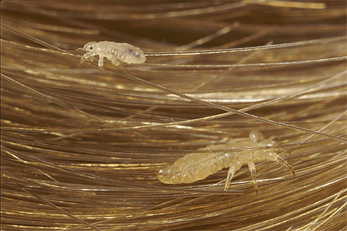 Läuse in den Haaren – das häufigste Bild dieser Parasiten in Träumen. Läuse in den Haaren – das häufigste Bild dieser Parasiten in Träumen.