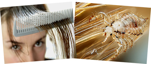 Versuchen wir zu verstehen, wie Träume mit Läusen in den Haaren zu deuten sind... Versuchen wir zu verstehen, wie Träume mit Läusen in den Haaren zu deuten sind