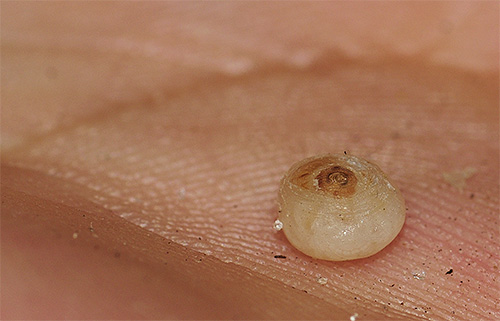 Der Körper des Weibchens des Sandflohs ist mit Eiern gefüllt - daher ist er so aufgebläht Der Körper des Weibchens des Sandflohs ist mit Eiern gefüllt - daher ist er so aufgebläht