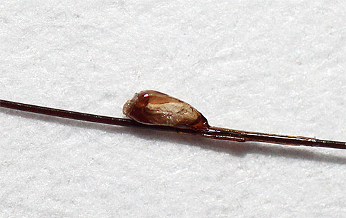 Es ist manchmal schwierig, Nissen nur mit insektiziden Mitteln loszuwerden. Es ist manchmal schwierig, Nissen nur mit insektiziden Mitteln loszuwerden.