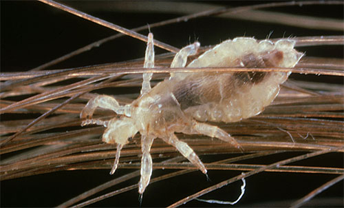 Die Kopflaus kann sich aufgrund des spezifischen Baus ihrer Beine sehr fest an den Haaren festhalten. Die Kopflaus kann sich aufgrund des spezifischen Baus ihrer Beine sehr fest an den Haaren festhalten.