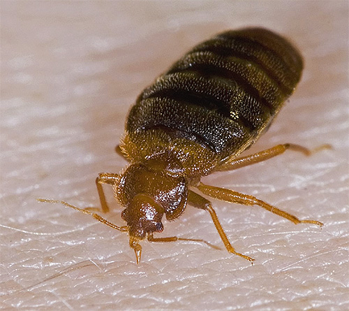 Bettwanzen stechen im Gegensatz zu Läusen hauptsächlich an unbedeckten Körperstellen (ohne Haare) Bettwanzen stechen im Gegensatz zu Läusen hauptsächlich an unbedeckten Körperstellen (ohne Haare)