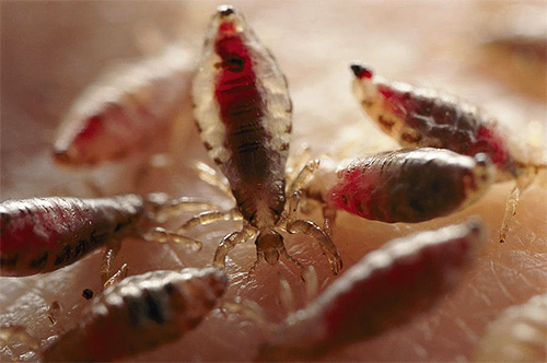 Auf dem Foto sind viele Läuse zu sehen, die sich mit Blut vollgesogen haben. Auf dem Foto sind viele Läuse zu sehen, die sich mit Blut vollgesogen haben.