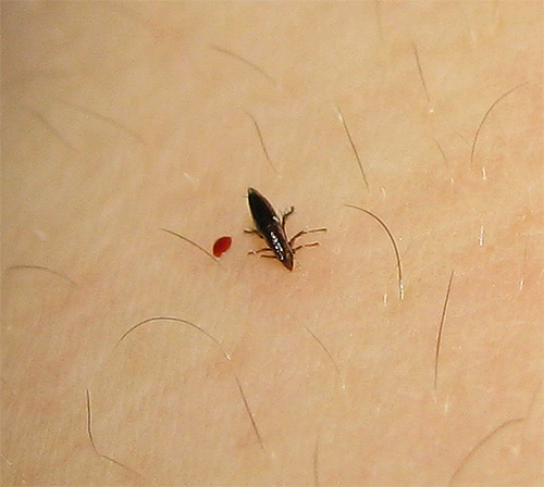 Flöhe sind blutsaugende Insekten und können potenziell viele gefährliche Infektionen übertragen... Flöhe sind blutsaugende Insekten und können potenziell viele gefährliche Infektionen übertragen...