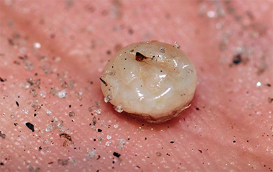 So sieht ein aus der Haut entfernter weiblicher Sandfloh aus, der von den in ihm reifenden Eiern aufgedunsen ist. So sieht ein aus der Haut entfernter weiblicher Sandfloh aus, der von den in ihm reifenden Eiern aufgedunsen ist.