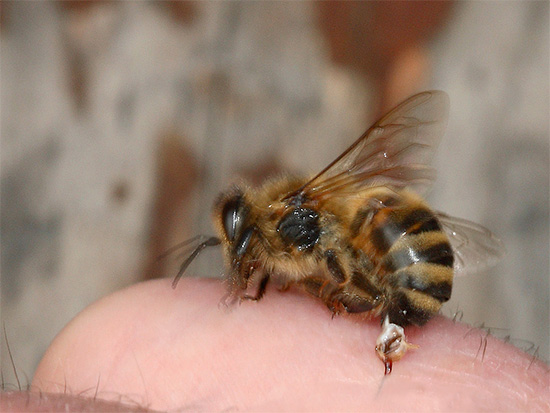Viele Insekten injizieren beim Stich Gift unter die Haut, was manchmal zu ernsthaften Schwellungen und Allergien führt.
