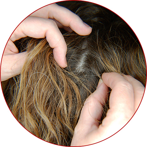 Heute kann man Läuse und Nissen in den Haaren ziemlich schnell loswerden, buchstäblich in einem Tag – darüber werden wir weiter sprechen... Heute kann man Läuse und Nissen in den Haaren ziemlich schnell loswerden, buchstäblich in einem Tag – darüber werden wir weiter sprechen...