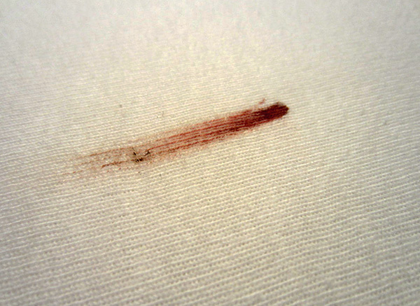 Nach dem Festmahl der nächtlichen Blutsauger bleiben auf dem Bett oft kleine Blutflecken zurück. Nach dem Festmahl der nächtlichen Blutsauger bleiben auf dem Bett oft kleine Blutflecken zurück.