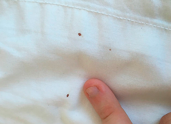 Es ist auch nützlich, vorbeugende Inspektionen des Bettlakens durchzuführen – Blutspuren darauf können auf das Auftreten von Schädlingen im Haus hindeuten. Es ist auch nützlich, vorbeugende Inspektionen des Bettlakens durchzuführen – Blutspuren darauf können auf das Auftreten von Schädlingen im Haus hindeuten.