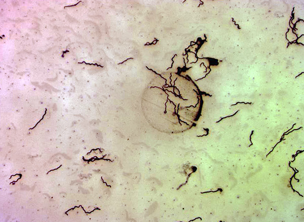 Borrelia burgdorferi unter dem Mikroskop (bei 400-facher Vergrößerung). Borrelia burgdorferi unter dem Mikroskop (bei 400-facher Vergrößerung).