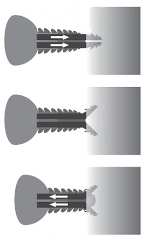 Das Bild zeigt schematisch, wie der Mundapparat der Zecke beim Stich in die Haut eindringt. Das Bild zeigt schematisch, wie der Mundapparat der Zecke beim Stich in die Haut eindringt.
