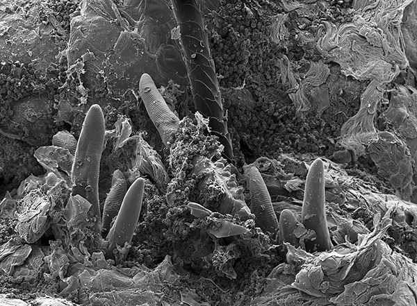 Durch die parasitäre Lebensweise der Haarbalgmilben leidet der menschliche Körper in den meisten Fällen nicht. Durch die parasitäre Lebensweise der Haarbalgmilben leidet der menschliche Körper in den meisten Fällen nicht.