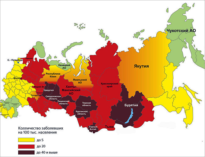 Karte der Verbreitung der Frühsommer-Meningoenzephalitis in der Russischen Föderation. Karte der Verbreitung der Frühsommer-Meningoenzephalitis in der Russischen Föderation.