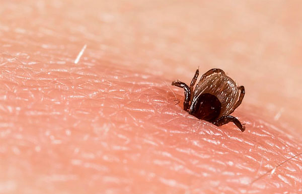In epidemiologisch ungünstigen Regionen sind nur 6 % der Zecken Überträger von für den Menschen gefährlichen Infektionen, aber am äußeren Erscheinungsbild kann man nicht erkennen, ob ein bestimmter Parasit ansteckend ist oder nicht. In epidemiologisch ungünstigen Regionen sind nur 6 % der Zecken Überträger von für den Menschen gefährlichen Infektionen, aber am äußeren Erscheinungsbild kann man nicht erkennen, ob ein bestimmter Parasit ansteckend ist oder nicht.