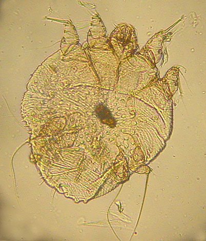 Weibchen der Krätzmilbe Weibchen der Krätzmilbe