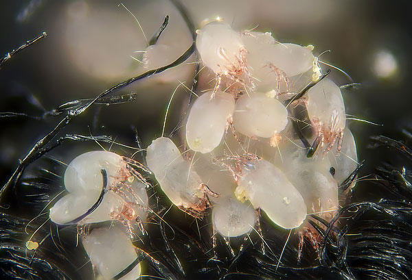 Mit bloßem Auge sind Hausstaubmilben Dermatophagoides pteronyssinus in einem Teppich praktisch nicht zu erkennen, weshalb die meisten Menschen glauben, sie seien nicht im Haus. Mit bloßem Auge sind Hausstaubmilben Dermatophagoides pteronyssinus in einem Teppich praktisch nicht zu erkennen, weshalb die meisten Menschen glauben, sie seien nicht im Haus.