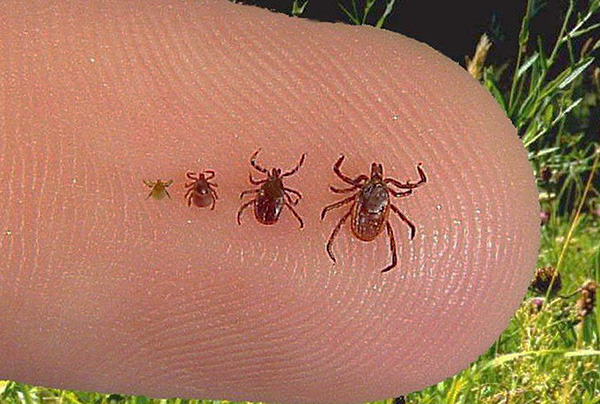 So sehen die Parasiten in verschiedenen Entwicklungsstadien aus. Und so sehen die Parasiten in verschiedenen Phasen ihrer Entwicklung aus.