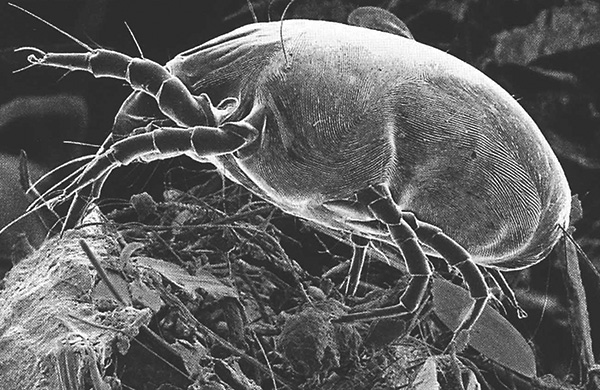 Dermatophagoides pteronyssinus (Foto aufgenommen mit einem Rasterelektronenmikroskop). Dermatophagoides pteronyssinus (Foto aufgenommen mit einem Rasterelektronenmikroskop).