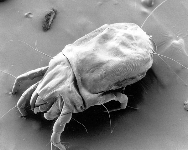 Dermatophagoides pteronyssinus unter dem Elektronenmikroskop Dermatophagoides pteronyssinus unter dem Elektronenmikroskop
