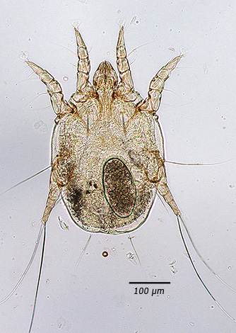 Otodectes cynotis unter dem Mikroskop, erwachsenes Exemplar Otodectes cynotis unter dem Mikroskop, erwachsenes Exemplar