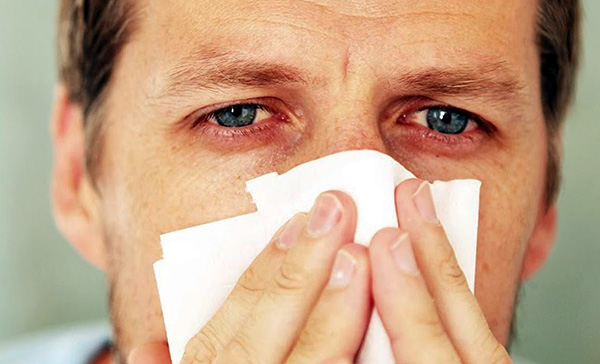Schnupfen, verstopfte Nase und Tränenfluss sind typische Symptome, die bei Einwirkung des Allergens auf die Schleimhäute der oberen Atemwege und der Augen auftreten. Schnupfen, verstopfte Nase und Tränenfluss sind typische Symptome, die bei Einwirkung des Allergens auf die Schleimhäute der oberen Atemwege und der Augen auftreten.