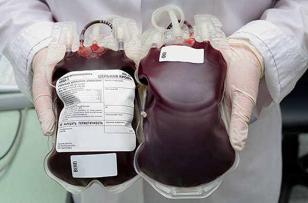 Immunglobulin wird aus dem Blutplasma von Spendern gewonnen. Immunglobulin wird aus dem Blutplasma von Spendern gewonnen.