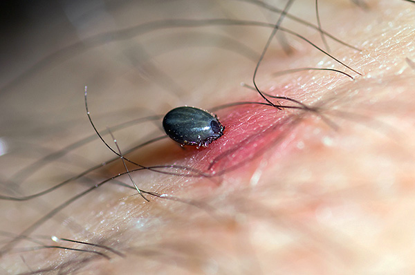 Wird eine geimpfte Person von einer mit dem FSME-Virus infizierten Zecke gestochen, entwickelt sich die Krankheit nicht oder verläuft in einer sehr milden Form. Wird eine geimpfte Person von einer mit dem FSME-Virus infizierten Zecke gestochen, entwickelt sich die Krankheit nicht oder verläuft in einer sehr milden Form.