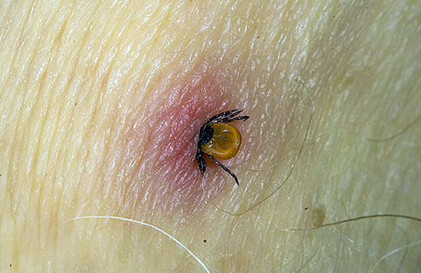 Der besondere Aufbau des Mundapparats der Schildzecken ermöglicht es ihnen, sich nach dem Stich sehr fest in der Haut des Wirts zu verankern. Der besondere Aufbau des Mundapparats der Schildzecken ermöglicht es ihnen, sich nach dem Stich sehr fest in der Haut des Wirts zu verankern.