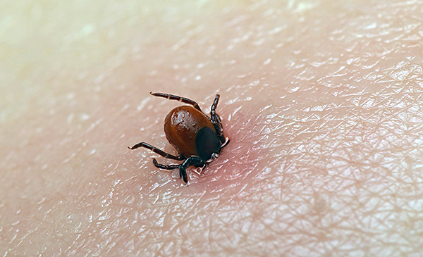 Mit zunehmender Blutaufnahme kann der Kopf der Zecke vollständig unter die Haut eintauchen. Mit zunehmender Blutaufnahme kann der Kopf der Zecke vollständig unter die Haut eintauchen.