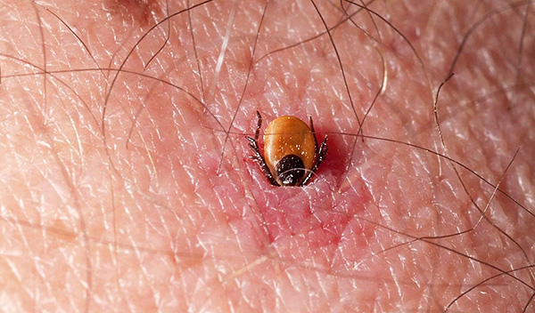 Der Parasit sticht nur einmal. Der Parasit sticht nur einmal.