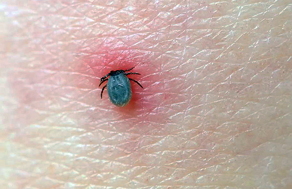 Während der Nahrungsaufnahme entwickelt sich der Organismus des Parasiten beschleunigt. Während der Nahrungsaufnahme entwickelt sich der Organismus des Parasiten beschleunigt.
