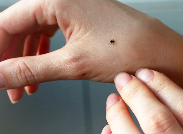 Schildzecken können Überträger einer Vielzahl von Infektionen sein, die größte epidemiologische Gefahr geht jedoch von der Frühsommer-Meningoenzephalitis (FSME) und der Lyme-Borreliose aus. Schildzecken können eine Vielzahl von Infektionen übertragen, die größte epidemiologische Gefahr geht jedoch von der Frühsommer-Meningoenzephalitis und der Lyme-Borreliose aus.