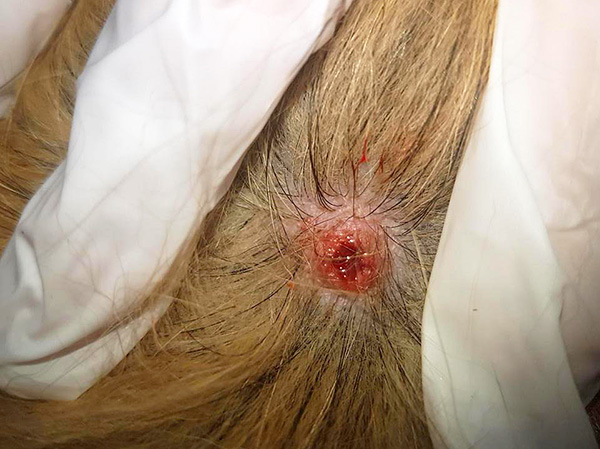 Wenn die Bissstelle einer Zecke lange Zeit nicht verheilt, sollte der Hund einem Tierarzt vorgestellt werden. Wenn die Bissstelle einer Zecke lange Zeit nicht verheilt, sollte der Hund einem Tierarzt vorgestellt werden.