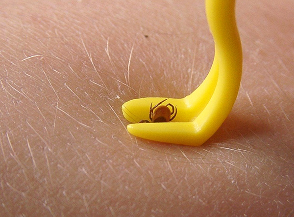 Den festsitzenden Parasiten kann man mit einem speziellen Zeckenentferner entfernen... Den festsitzenden Parasiten kann man mit einem speziellen Zeckenentferner entfernen...